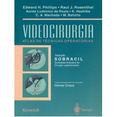 Videocirurgia