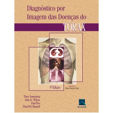 Diagnóstico por Imagem das Doenças do Tórax