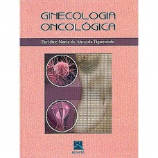 Ginecologia Oncológica Ginecologia Oncológica