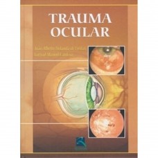 Trauma Ocular Trauma Ocular