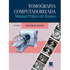 Tomografia Computadorizada