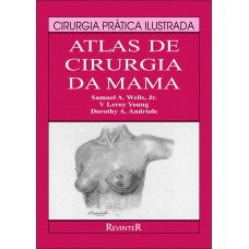 Atlas de Cirurgia da Mama