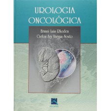 Urologia Oncológica