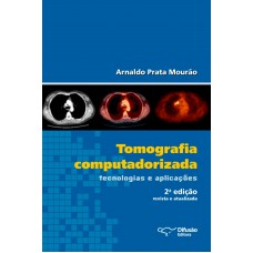 Tomografia computadorizada