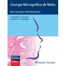 Cirurgia Micrográfica de Mohs