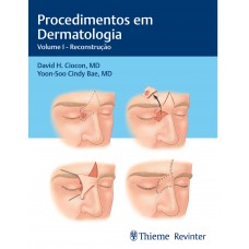 Procedimentos em Dermatologia