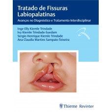 Tratado de Fissuras Labiopalatinas