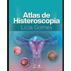 Atlas de Histeroscopia