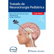 Tratado de Neurocirurgia Pediátrica