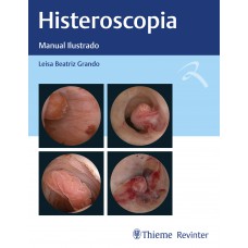 Histeroscopia