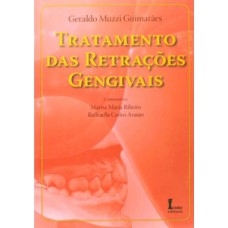 Tratamento das retrações gengivais