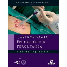 Gastrostomia endoscópica percutânea