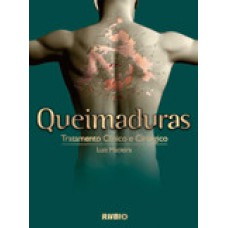 Queimaduras – tratamento clínico e cirúrgico