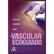 Guia prático de acesso vascular ecoguiado