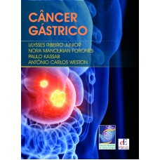 Câncer Gástrico