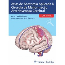 Atlas de Anatomia Aplicada à Cirurgia da Malformação Arteriovenosa Cerebral