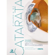 Cirurgia de Catarata Cirurgia de Catarata