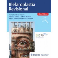 Blefaroplastia Revisional Blefaroplastia Revisional