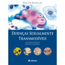 Doenças sexualmente transmissíveis