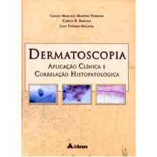 Dermatoscopia - Aplicação clínica e correlação histopatológica