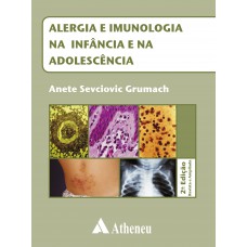 Alergia e imunologia na infância e na adolescência