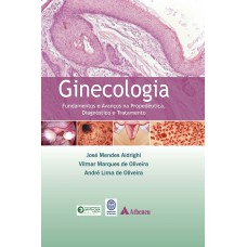 Ginecologia - fundamentos e avanços na propedêutica