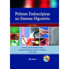 Próteses endoscópicas do aparelho digestório