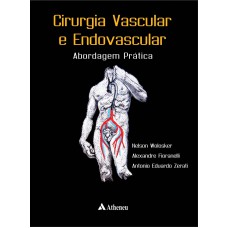 Cirurgia vascular e endovascular