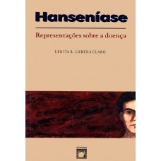 Hanseníase